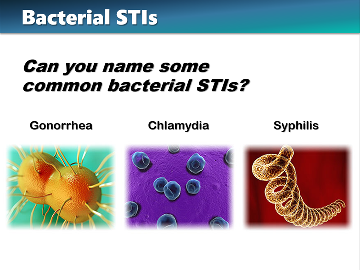 Bacterial STIs Sample PowerPoint Slide Image of common bacterial STIs: gonorrhea, chlamydia, syphilis